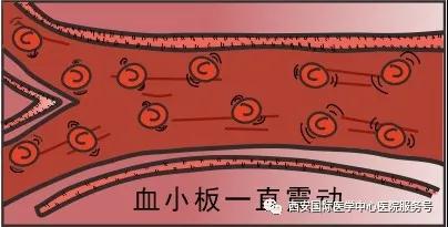 血小板是正常值的三倍？專(zhuān)家提醒小心血栓和出血！