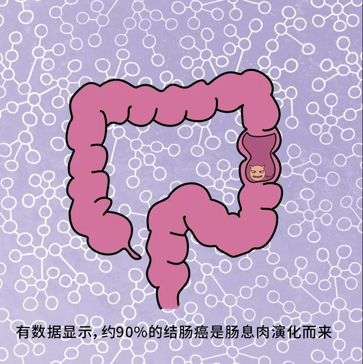 奪走“黑豹”生命的結(jié)腸癌，到底什么來頭？