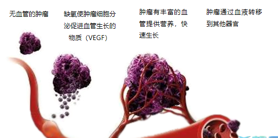 晚期腫瘤為什么會(huì)復(fù)發(fā)轉(zhuǎn)移？