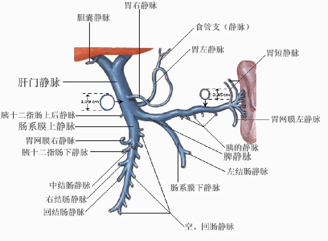 反復嘔血、黑便怎么辦？TIPS手術能解決
