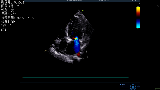 心電圖異常，心臟卻沒事，罪魁禍?zhǔn)资恰?>
				             </a>
                <div   id=