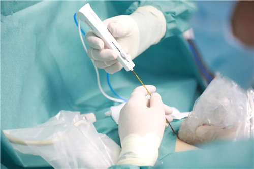 針尖上的絕絕子①｜從重慶到西安，23歲的姑娘只為了這件事……周曉東和他的超聲團隊