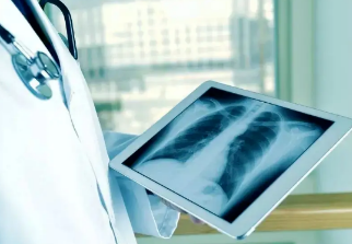 健康呼吸④體檢發(fā)現(xiàn)肺結(jié)節(jié)，我該怎么辦？