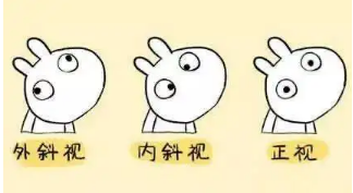 小baby老歪著頭？警惕斜頸! 這樣糾正……