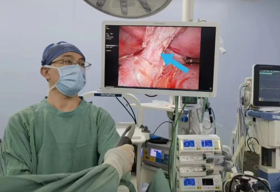 30歲小伙持續(xù)發(fā)燒咳嗽，原來是多長一塊肺......