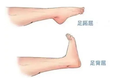 扭胯小連步、動感搖花手……“科目三”雖火，運動損傷也要防！