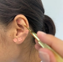 中醫(yī)護(hù)眼 點(diǎn)亮“睛”彩世界！又一波福利來(lái)襲