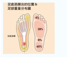 每年新生數(shù)百萬(wàn)足底筋膜炎患者！國(guó)際醫(yī)學(xué)專家提醒：跑步要選擇合適的鞋